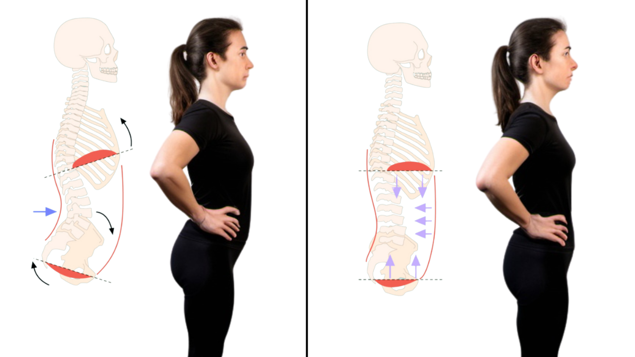Illustration comparing two standing pelvic positions